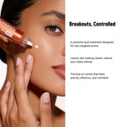 Acne Free Terminator 10 Acne Spot Treatment