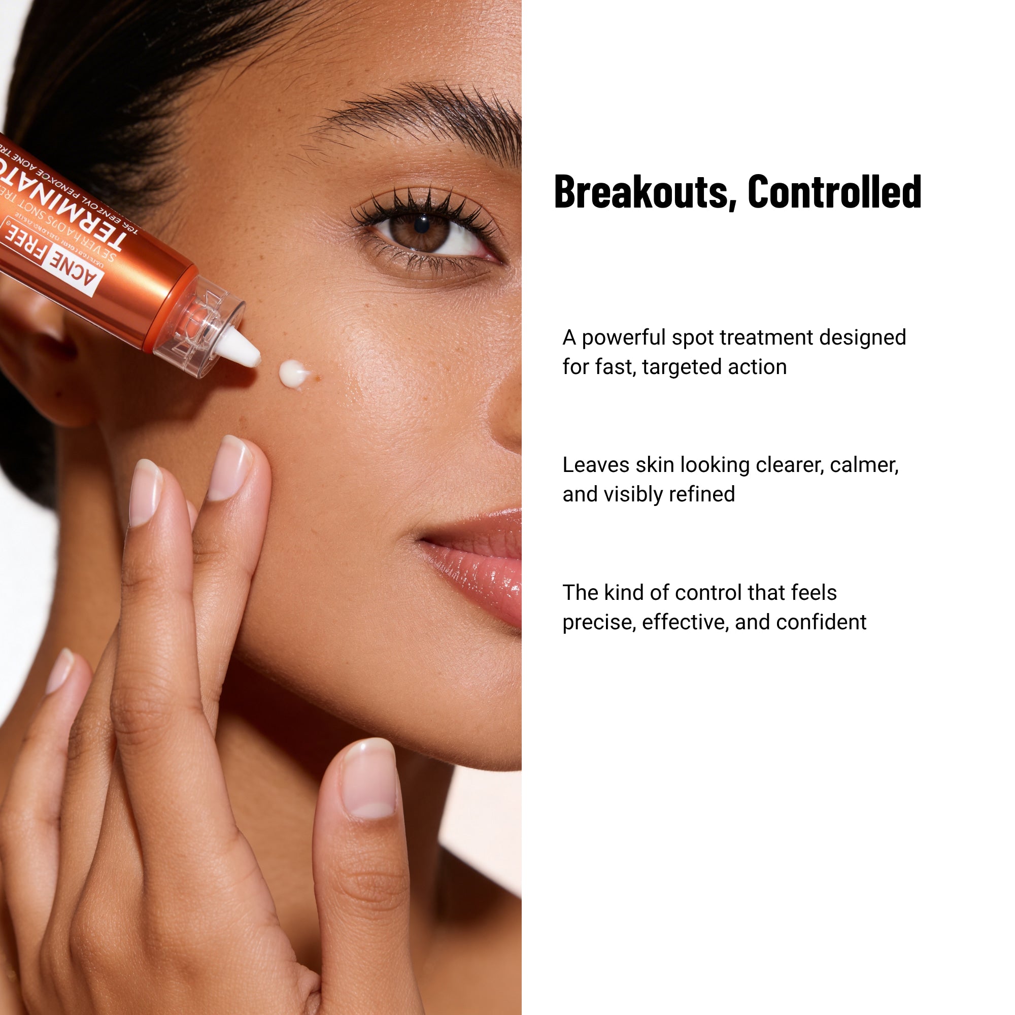 Acne Free Terminator 10 Acne Spot Treatment