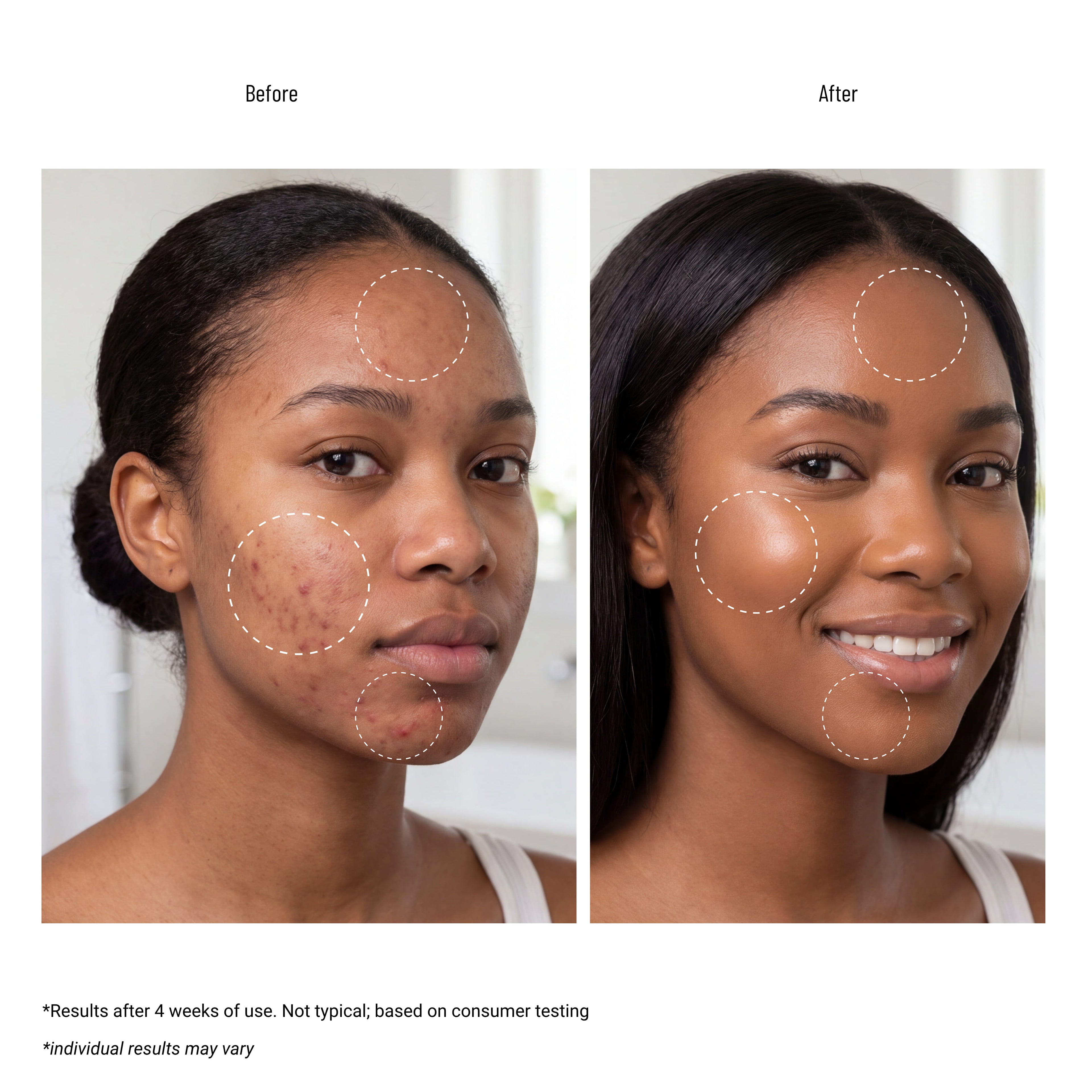 COSRX AC Collection Blemish Spot Clearing Serum 40ml