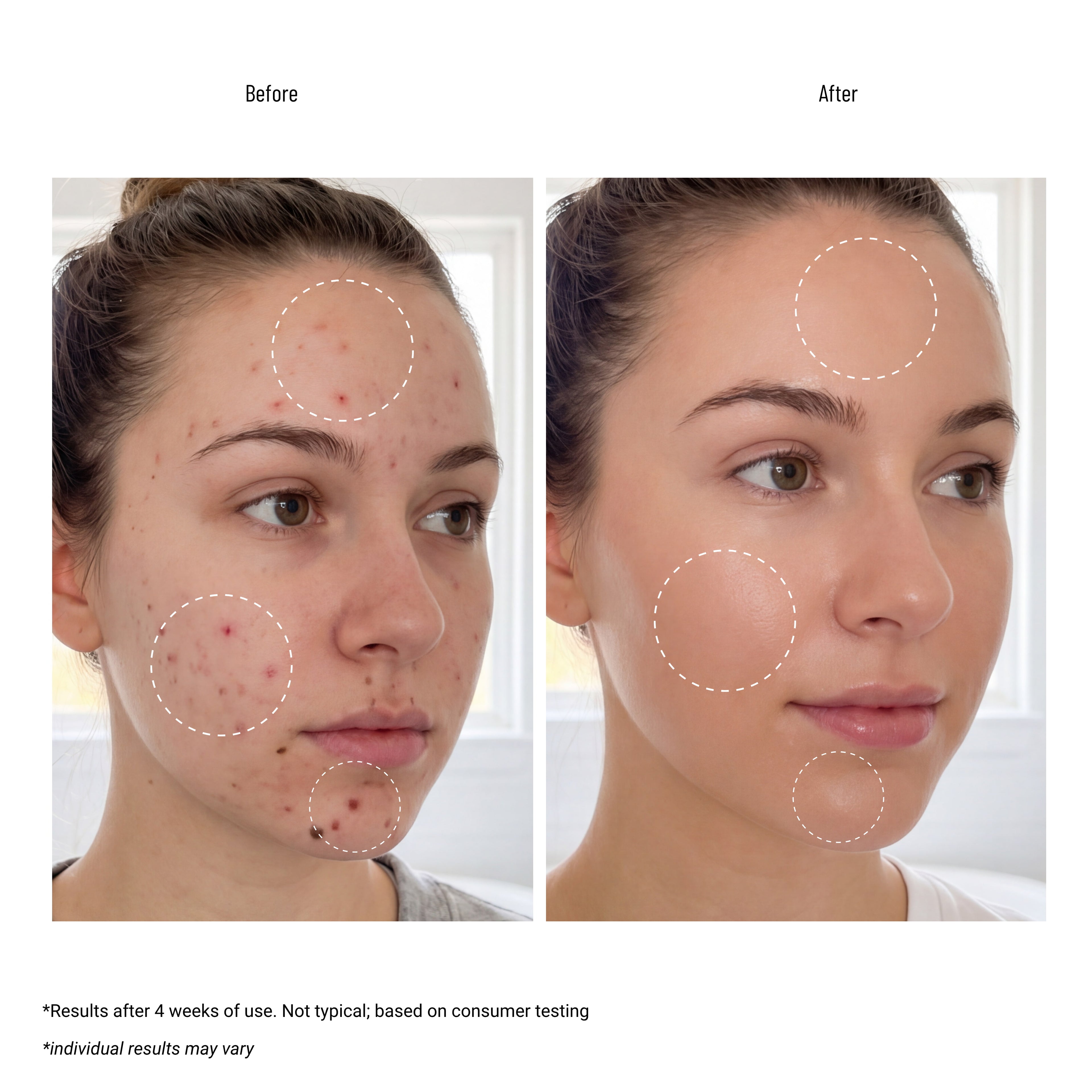 COSRX AC Collection Blemish Spot Clearing Serum 40ml