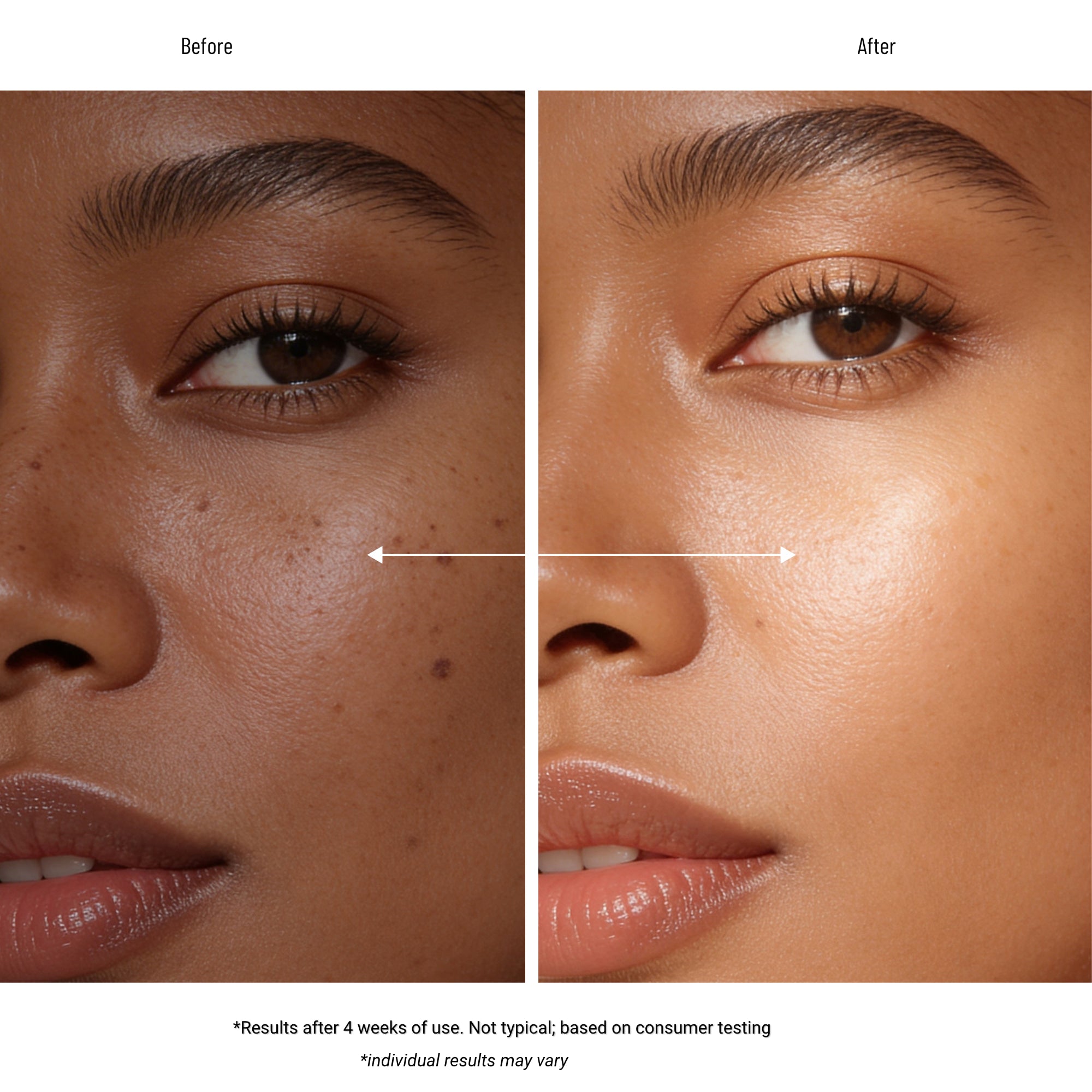 Eclat Vitamin C & Retinol Serum Set for Dull & Wrinkled Skin