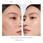 Glytone Acne Clearing Cleanser for Acne & Blemishes