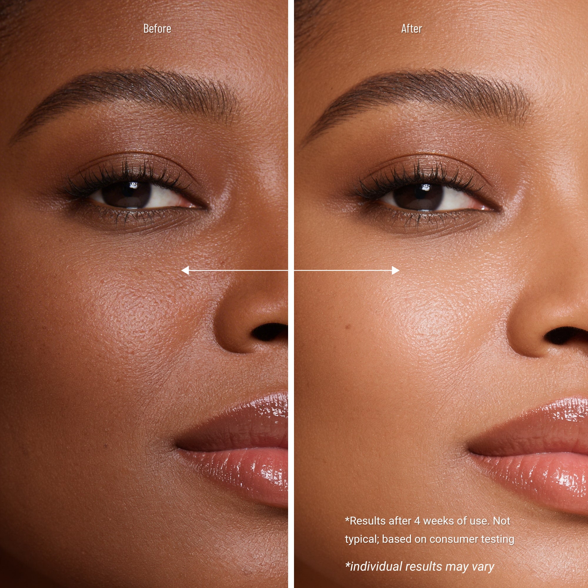 It’s Skin Collagen Nutrition Cream for Dry, Aging Skin