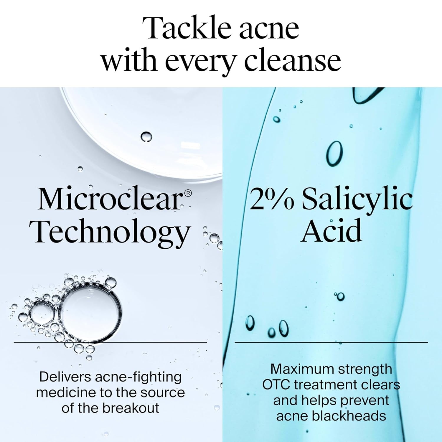 Product advertisement for a skincare solution with text about microclear technology and 2% salicylic acid.