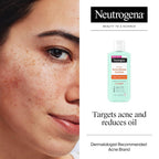 Neutrogena acne treatment product with a close-up of a face showing acne.