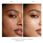 Neutrogena Clear and Defend Face Scrub for Acne & Congestion