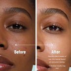 Neutrogena Oil-Free Moisturizer for Sensitive and Dry Skin