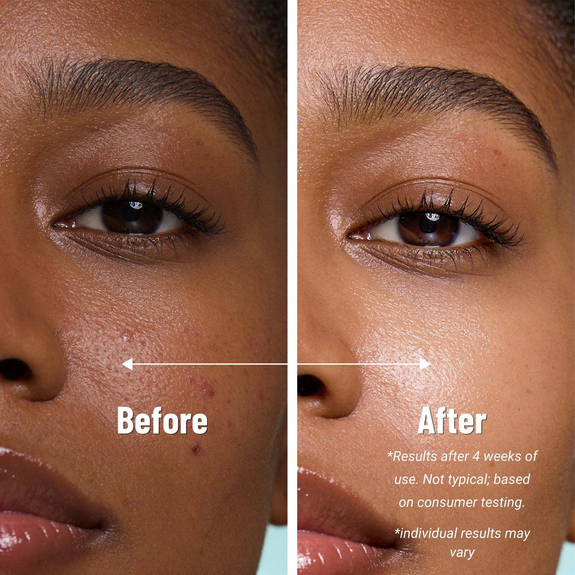 Neutrogena Oil-Free Moisturizer for Sensitive and Dry Skin