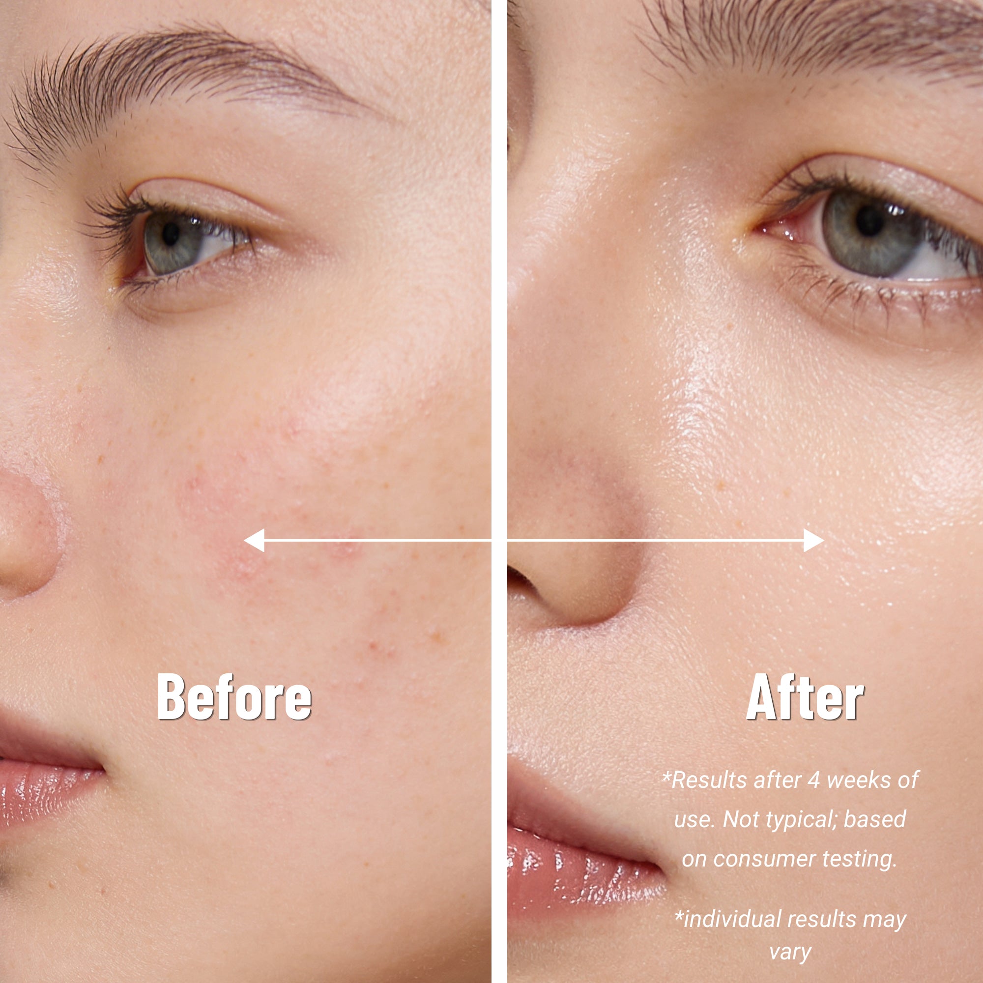 Neutrogena Oil-Free Moisturizer for Sensitive and Dry Skin