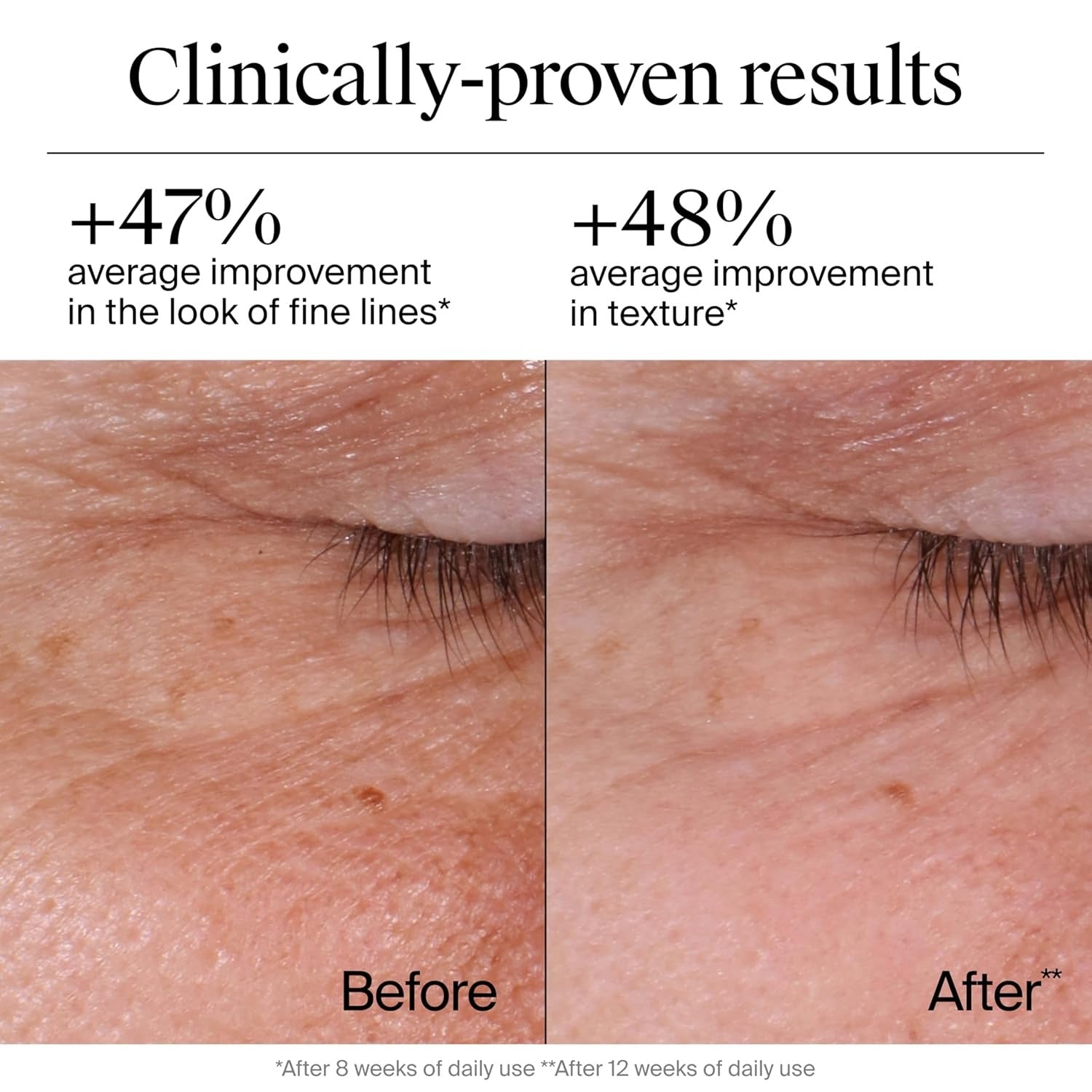 Before and after comparison of skin texture with clinically-proven results text.