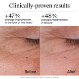 Before and after comparison of skin texture with clinically-proven results text.