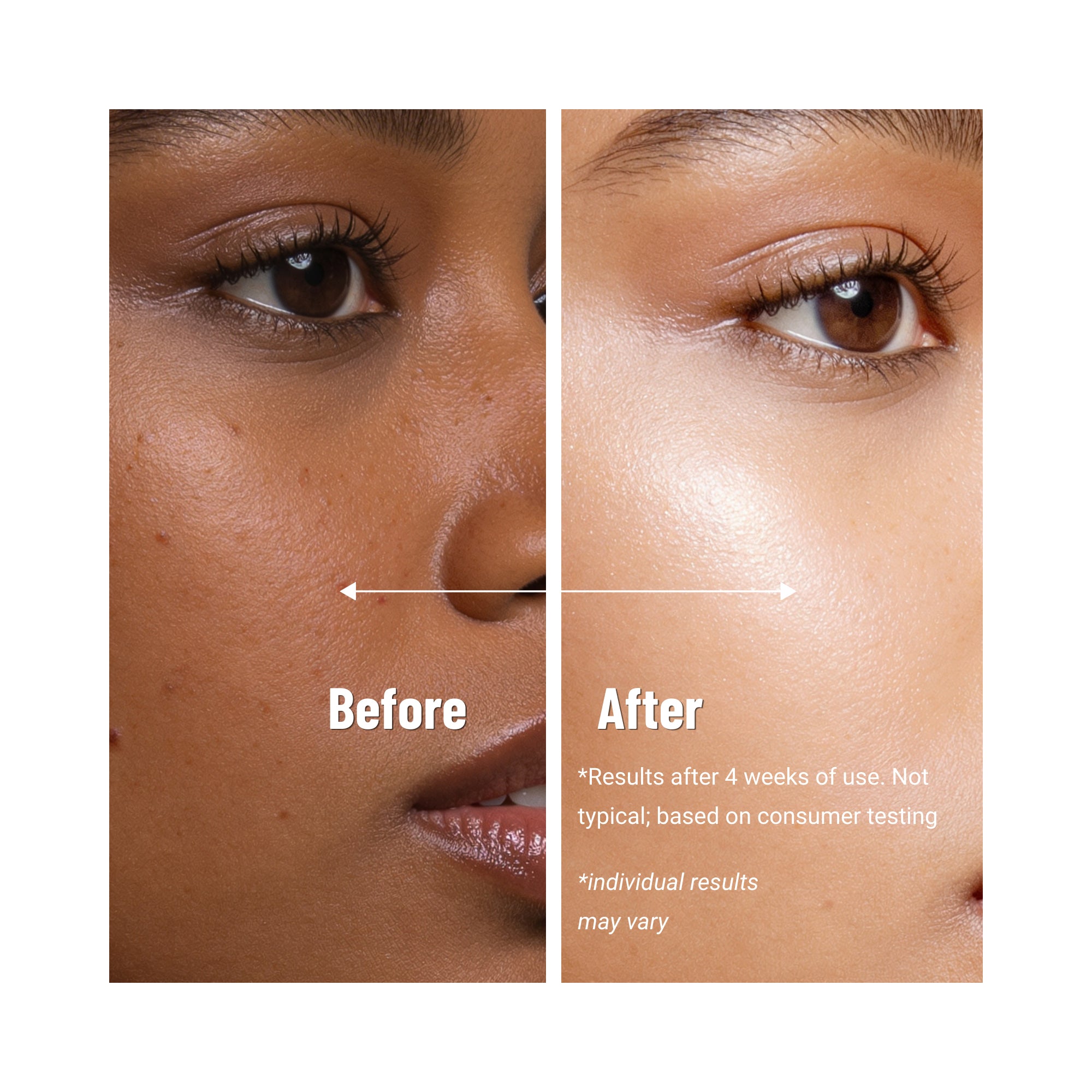 Olay-7-in-1 Tone Correcting Moisturizer for Uneven Skin