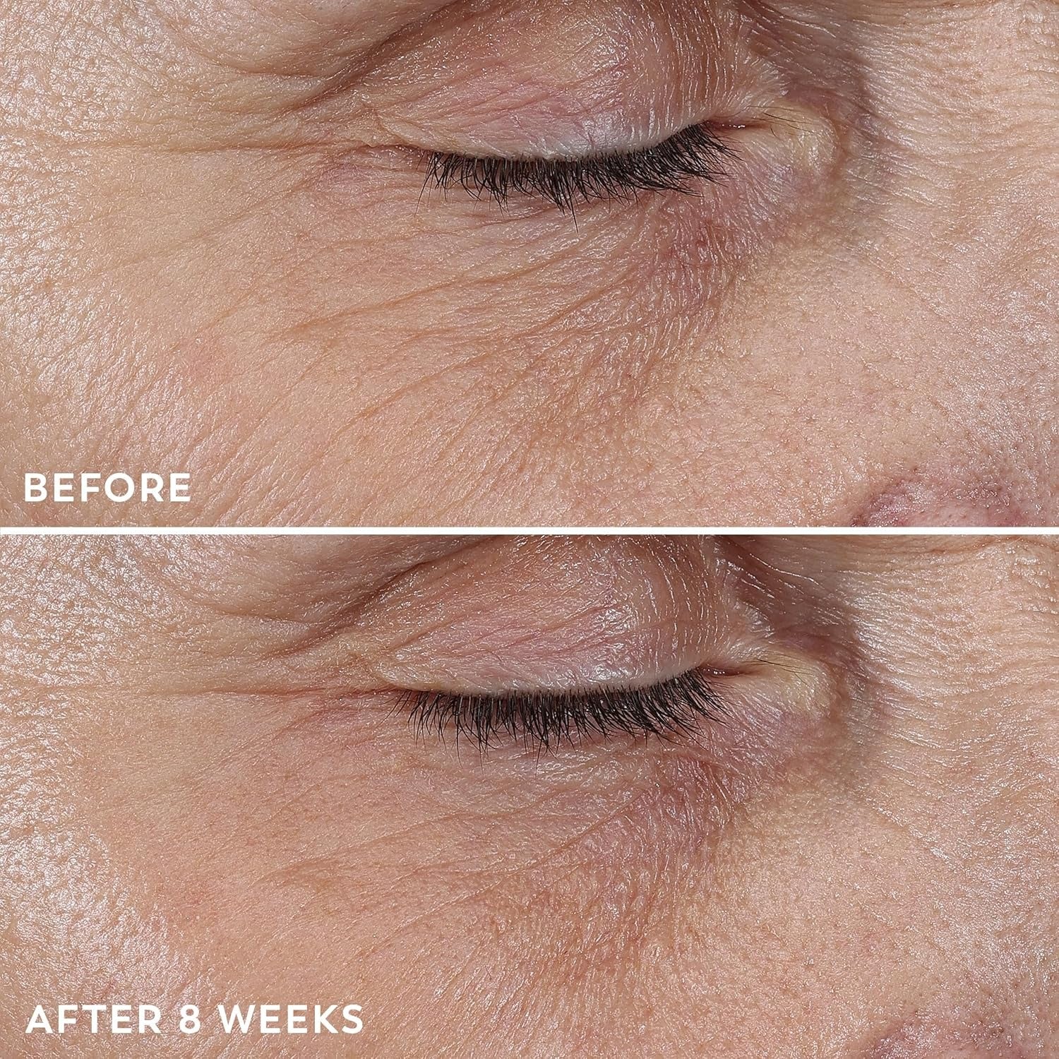 Before and after comparison of eye area skin texture with text labels 'Before' and 'After 8 Weeks'.