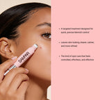 Sampar Prodigal Pen-Roll-On Acne Treatment  for Rapid Acne Spot Relief