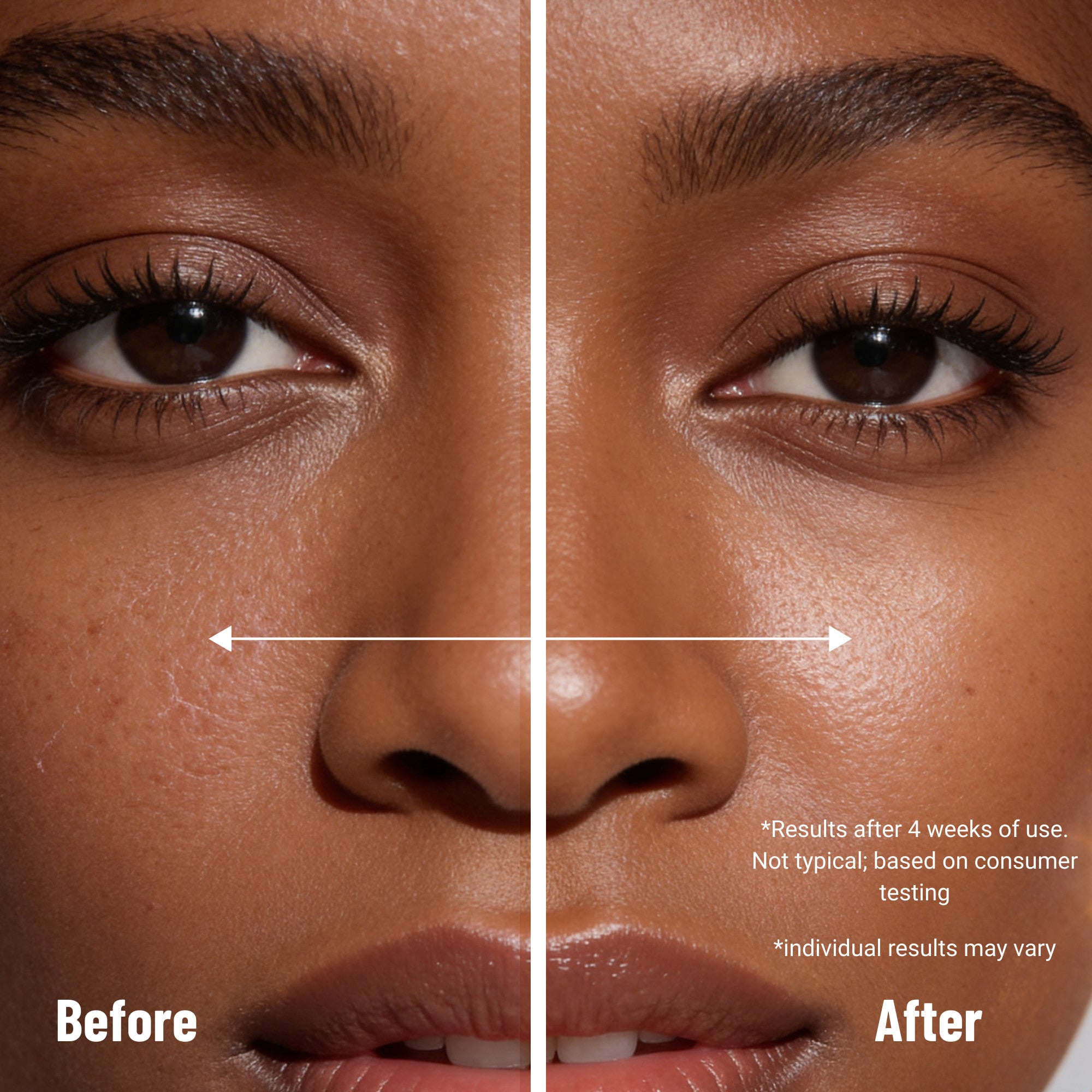 Before and after comparison of a woman's face with skin treatment results.
