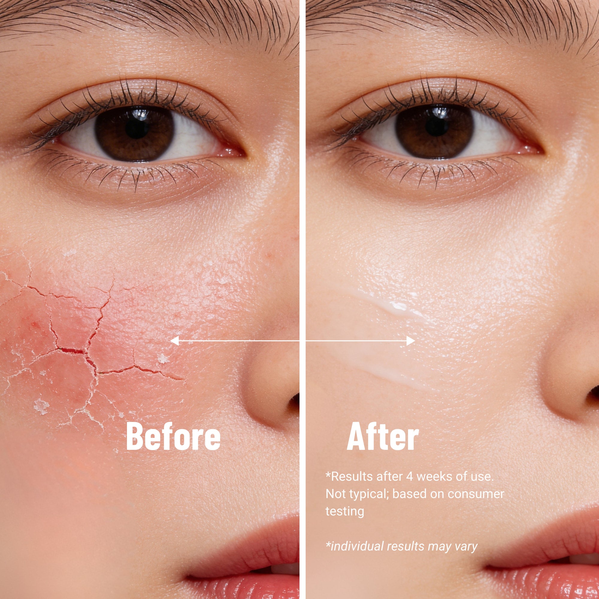Vanicream Moisturizing Skin Cream for Dry Sensitive Irritated Skin